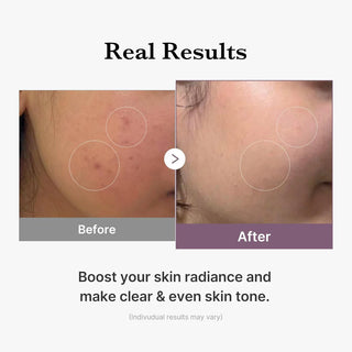 age-r glutathione glow milk toner MEDICUBE 140ml MEDICUBE AGE -R GLUTATHIONE GLOW