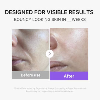 Medicube AGE-R Booster Pro Mini Plus Facial Cleansing Device