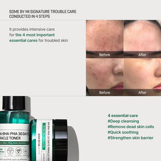 SOME BY MI AHA BHA PHA 30Days Starter Kit