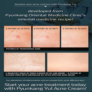 Pyunkang Yul Acne Cream