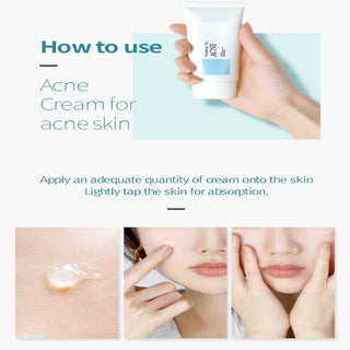 Pyunkang Yul Acne Cream