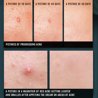 Pyunkang Yul Acne Spot Cream