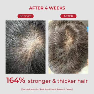 MOEV Annurcatin Shampoo