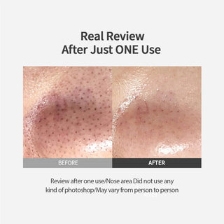 Sungboon Editor Blackhead Melting Clear Pad (30pads)