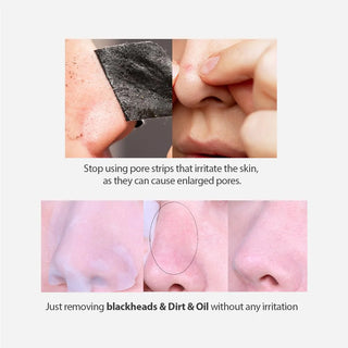 Sungboon Editor Blackhead Melting Clear Pad (30pads)