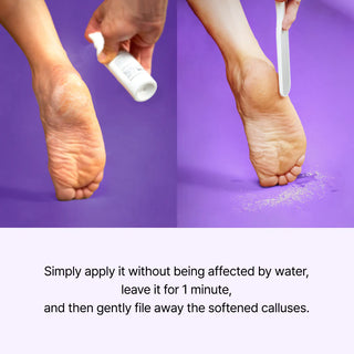 Baren Callus Remover Peeling Foot Spray