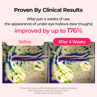 Dr.Melaxin Cemenrete Cyano Pink Spicule Cream