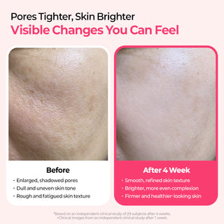 Dr.Melaxin Cemenrete Cyano Pink Spicule Serum