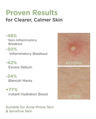 AROCELL Cica Hydrogel PDRN Mask (4 Sheets)