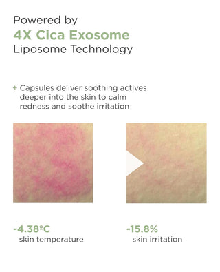 AROCELL Cica Hydrogel PDRN Mask (4 Sheets)