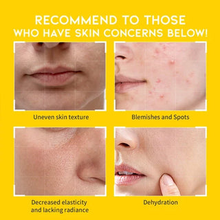 OOTD Dark Spot Vitamin C Toner Pad