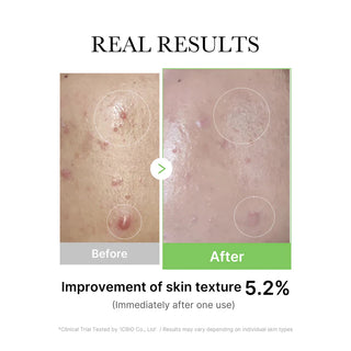 Medicube Exosome Cica Calming Ampoule