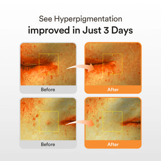 Abib Glutathiosome dark spot serum Vita drop