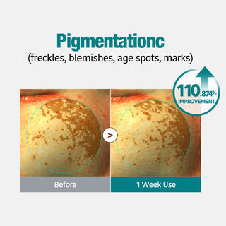 Goodal Green Tangerine Vita C Dark Spot Care Gel Mask (1 Sheet)