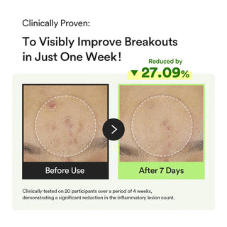 Abib Heartleaf TECA Capsule Serum Calming Drop