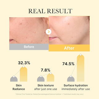 Medicube  Kojic Acid Turmeric Gold Jelly Gel Mask (4 Sheets)