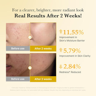 Medicube Kojic Acid Turmeric Capsule Serum