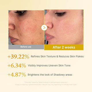 Medicube Kojic Acid Turmeric Toner