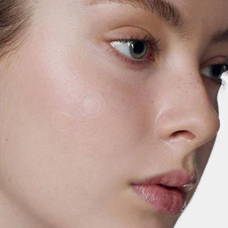 SOME BY MI Micro Pin Spot Patch