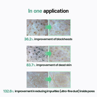 ilso Natural Mild Cleansing Oil