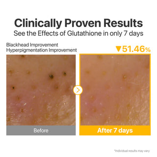 Numbuzin No.5 Glutathione C Facial Spa Cleansing Oil