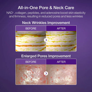 Numbuzin No.9 NAD+ BIO Lifting-sil Full Face Mask (4 Sheets)