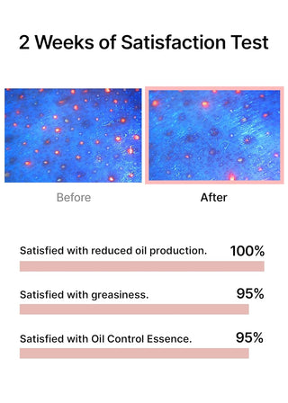 Celimax Oil Control Capsule Essence