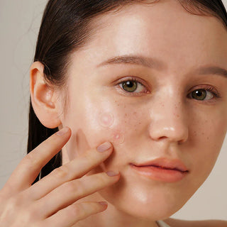 ISNTREE Onion Newpair Spot Patch Basic