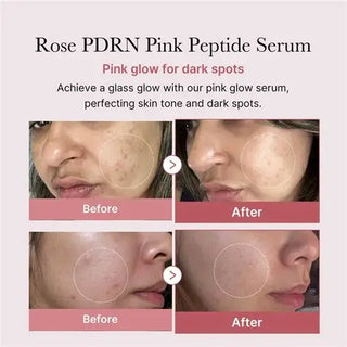 MedicubePDRN Pink One Day Serum