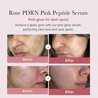 Medicube PDRN Pink Peptide Serum
