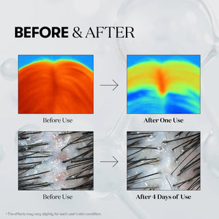 VT Cosmetics PDRN Reedle Shot Hair Ampoule 300dL