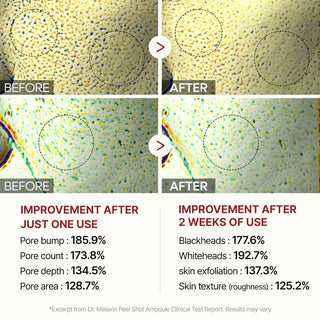 Dr.Melaxin Peel Shot Glow White Rice Ampoule