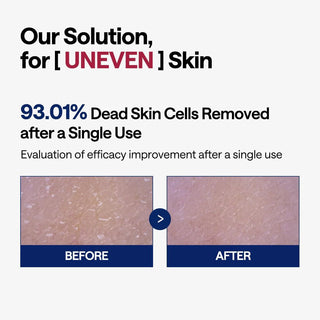 Mediheal Phyto Enzyme Exfoliating Peeling Pad