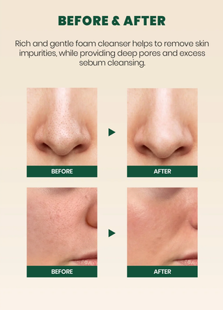 K-SECRET SEOUL 1988 Pine Cica 1% + Probiotics Cleansing Foam