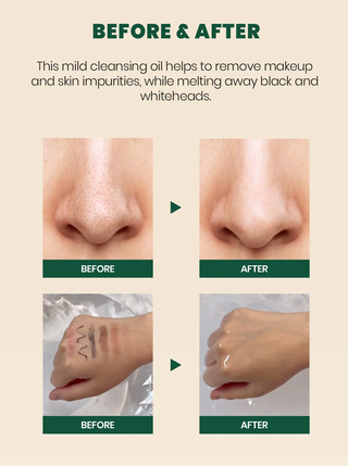 K-SECRET SEOUL 1988 Pine Cica 1% + Probiotics Cleansing Oil