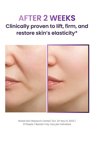 BIOHEAL BOH Probioderm 3D Lifting Travel Kit