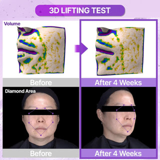 BIOHEAL BOH Probioderm™ 3D Lifting Ampoule