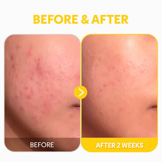 TIRTIR Pure Vitamin C24 Serum