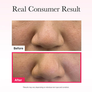 Arencia Red Collagen Jello Mask Set (4 Sheets)