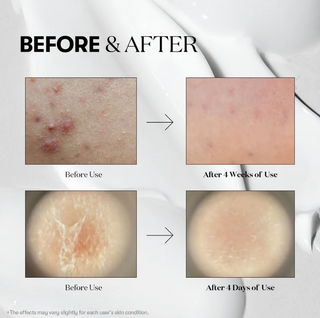 VT Cosmetics Reedle Shot 300 Essence