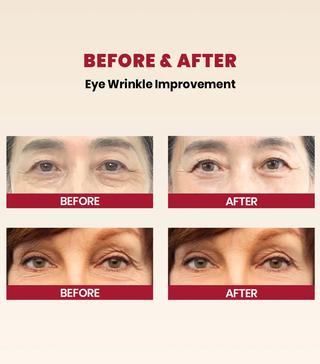 K-SECRET SEOUL 1988 Eye Cream: Retinal Lipsome 4% + Fermented Bean