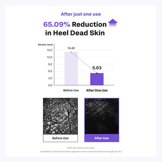 Baren Shea Butter Sleeping Heel Patch