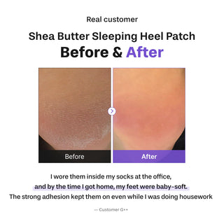 Baren Shea Butter Sleeping Heel Patch