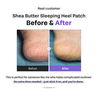 Baren Shea Butter Sleeping Heel Patch