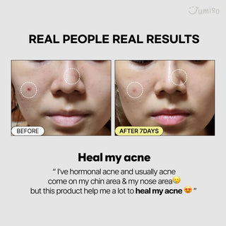 Jumiso Snail Mucin 95% + Peptide Essence