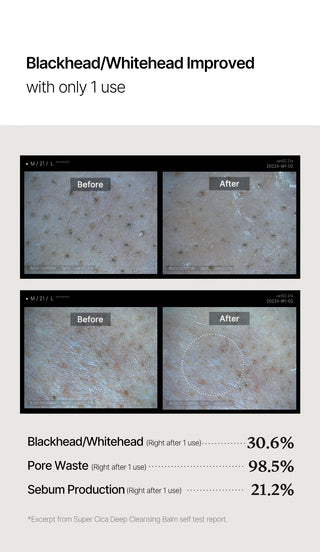 Medicube Super Cica Exfoliating Cleansing Balm