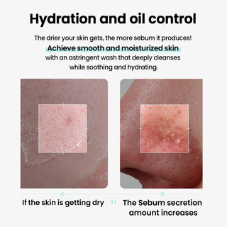 ilso Super Melting Sebum Cleansing Oil