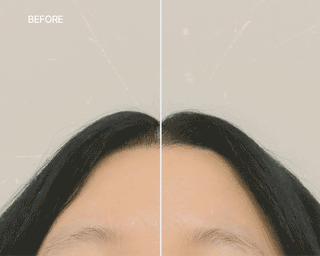 Hetras Vidangyeol Treatment