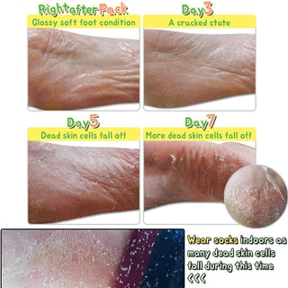 Elizavecca Witch Piggy Hell Turtle's Foot Pack (1 Pair)