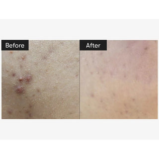 VT Cosmetics Reedle Shot 100 Essence 50ml